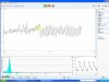 emWave PRO + КОМБО Пакет - диагностично - терапевтична система за мониторинг на вегетативния баланс и тренинг на психична устойчивост с биофийдбек измерване на промените в сърдечния ритъм (HRV)